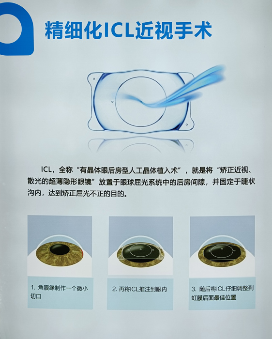 寒假摘鏡總動員，近視朋友的三種矯正近視方式