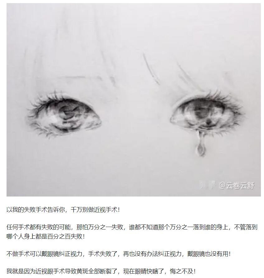 教你，怎樣去了解近視手術(shù)  